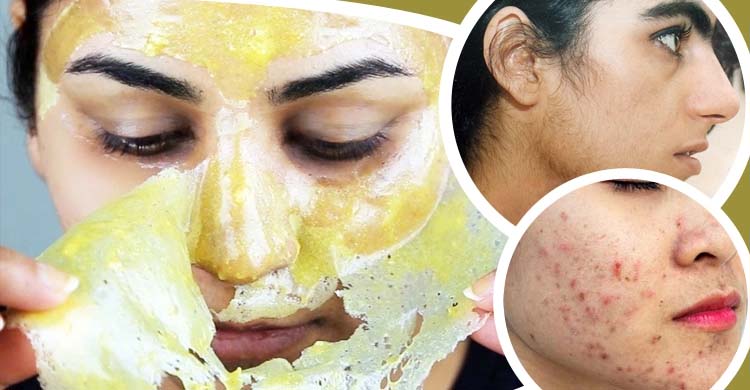 মুখের কালো দাগ ও লোম তুলতে যেভাবে মাখবেন ডাল 