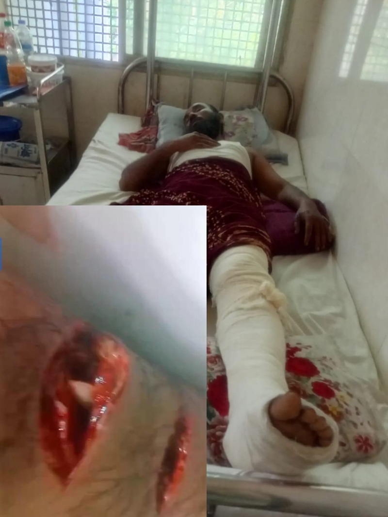 মৌলভীবাজারে ফল ব্যবসায়ী আব্দুর রহিমকে কুপিয়ে জখম - থানায় অভিযোগ 