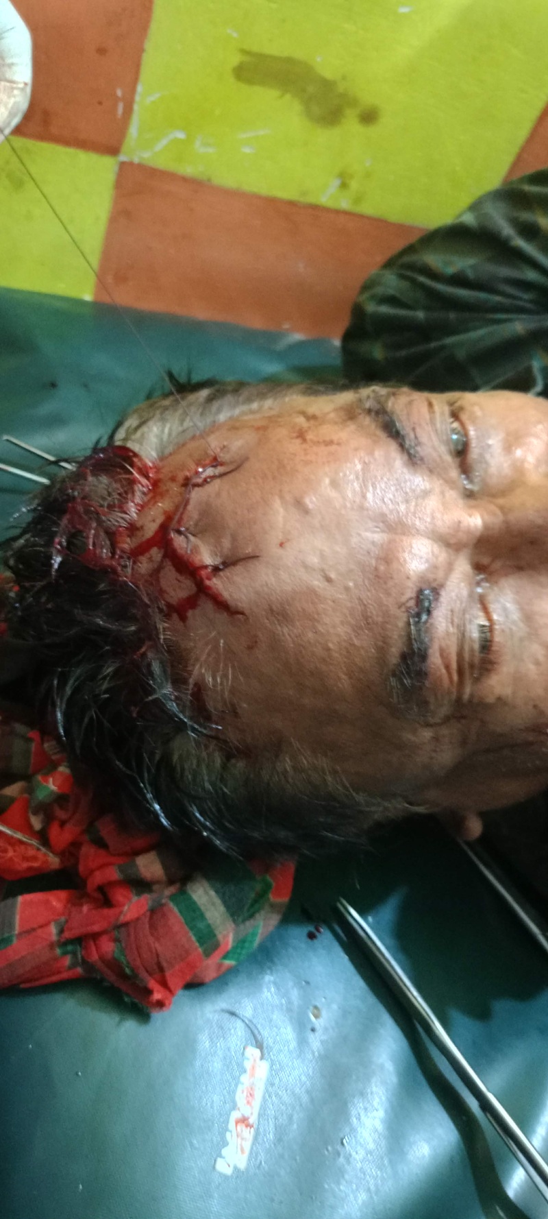 স্কুল শিক্ষক ভাইয়ের ধারালো অস্ত্রের আঘাতে মাথায় রক্তাক্ত জখম বড় ভাই গনেশ চন্দ্র
