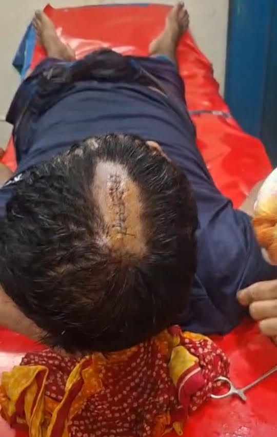 আগৈলঝাড়ায় মাছের ঘের নিয়ে বিরোধে হামলা, আহত ২