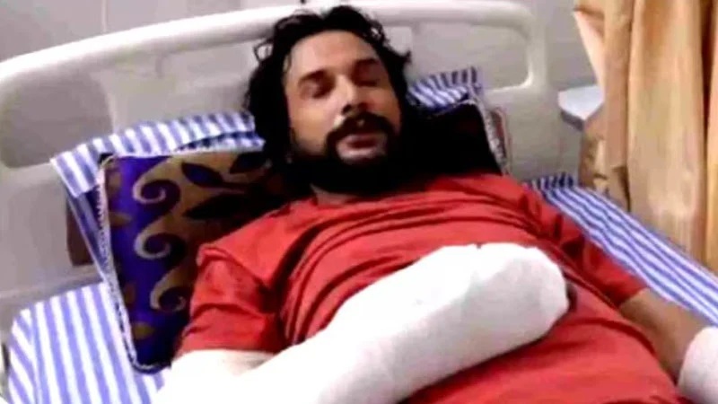 বিয়ে করতে রাজি না হওয়ায় পিটিয়ে প্রেমিকের হাত-পা ভাঙলেন তরুণী 