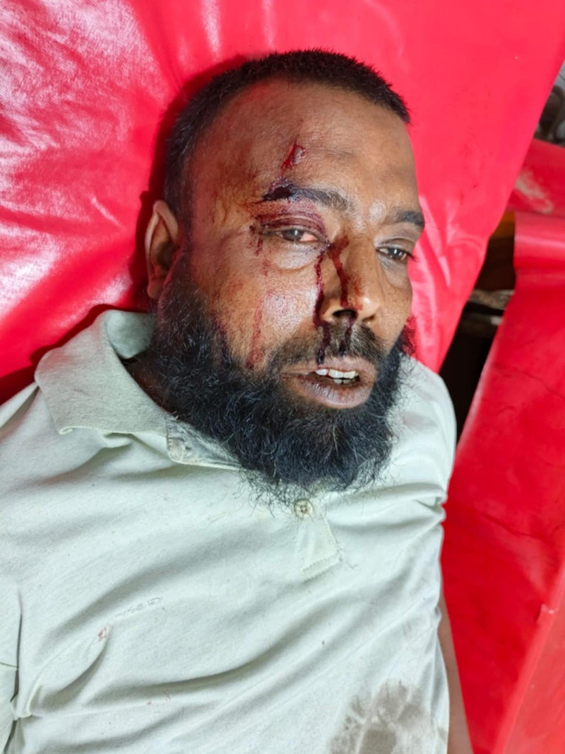 লক্ষ্মীপুরে অসহায় ব্যক্তিকে খাবার দেওয়ায় দম্পতির ওপর হামলা