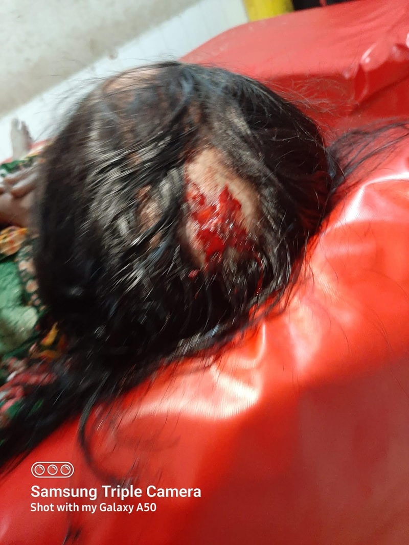 লক্ষ্মীপুরে জমি সংক্রান্ত বিরোধের জেরে প্রবাসী পরিবারের উপর হামলা 